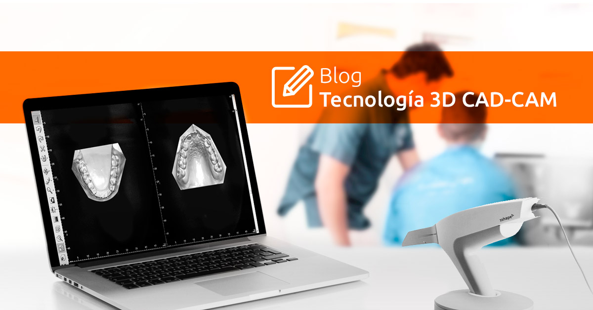 Tecnología 3D CAD CAM