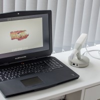 escaner intraoral portatil