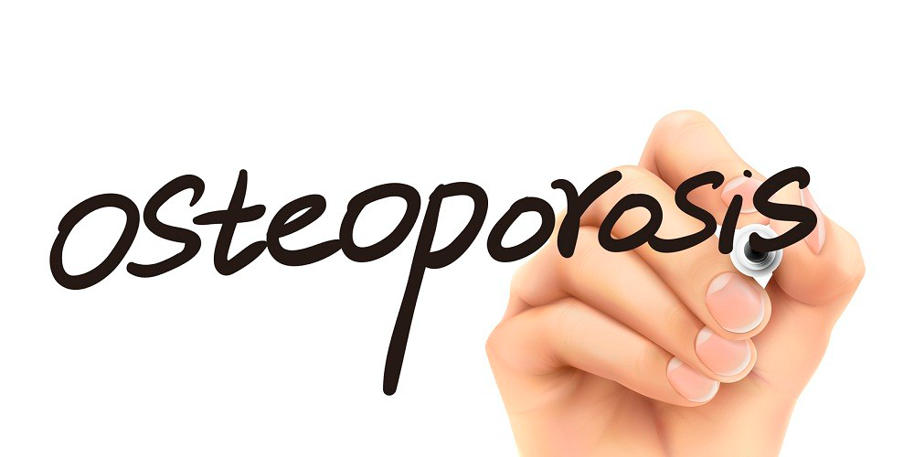 Osteoporosis tratada con bifosfonatos