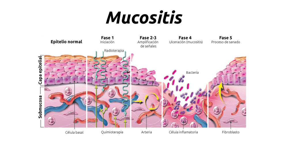 mucositis