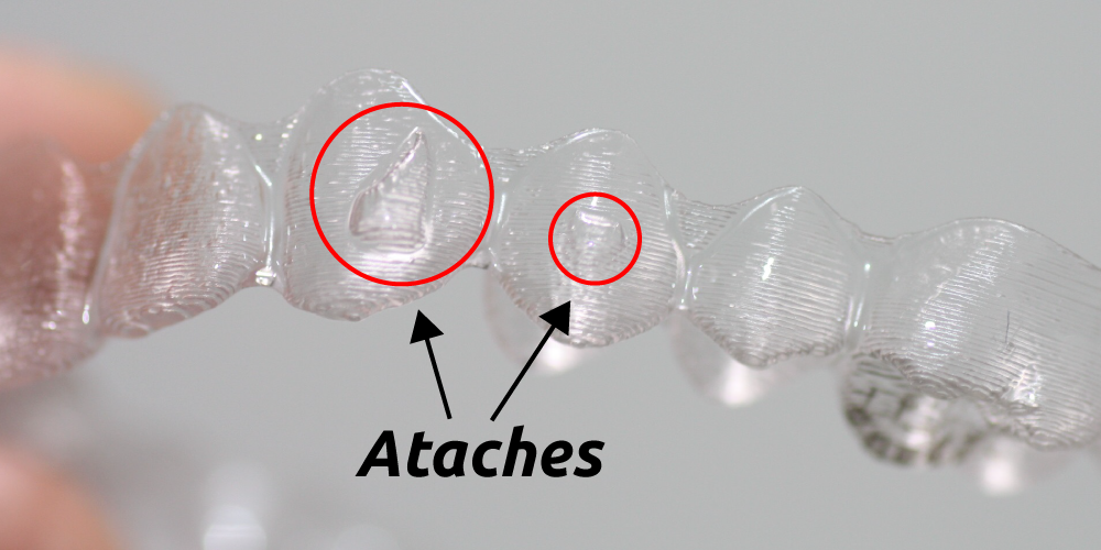 attachments invisalign