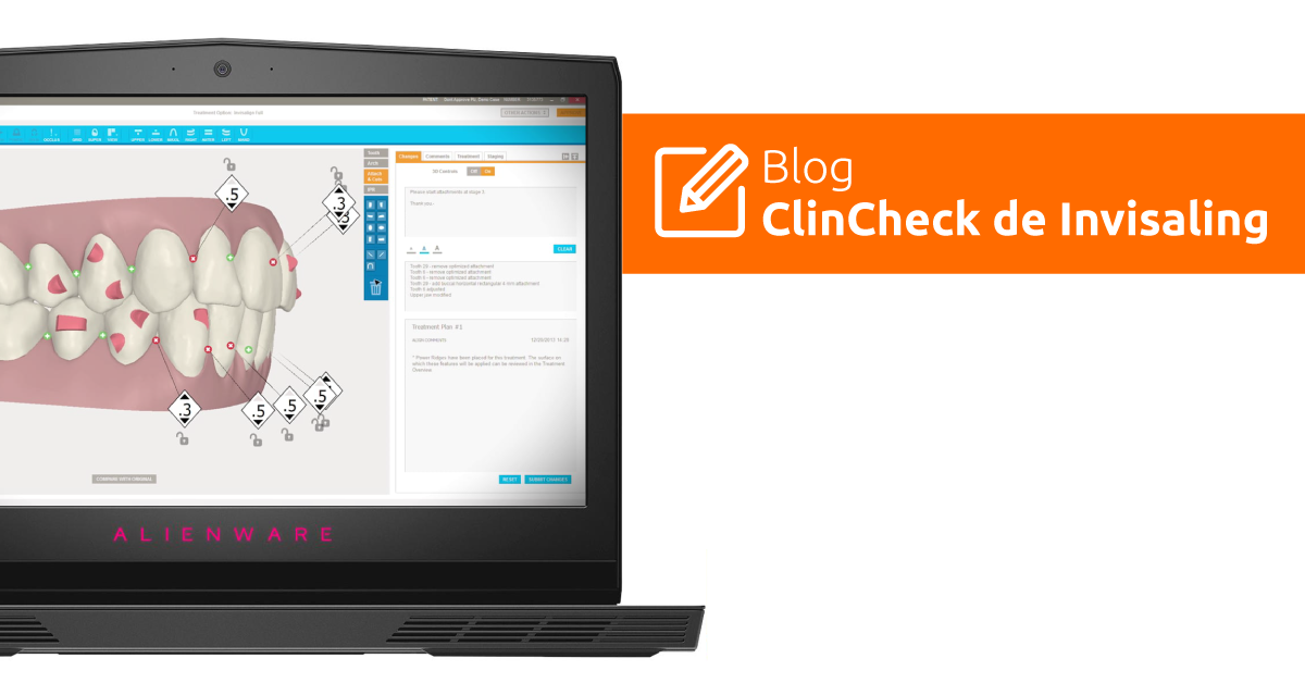 ClinCheck de Invisalign Facebook